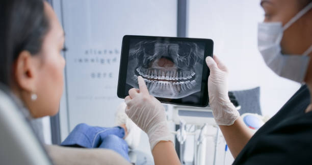 Licensed Tooth Extraction service in Oviedo, FL - Smile Center Dentistry